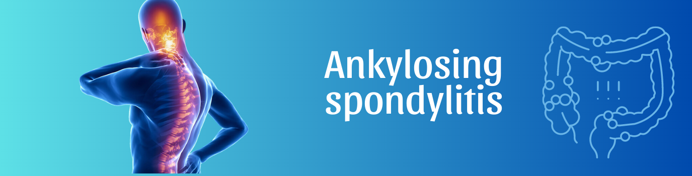 Ankylosing_spondylitis16732498